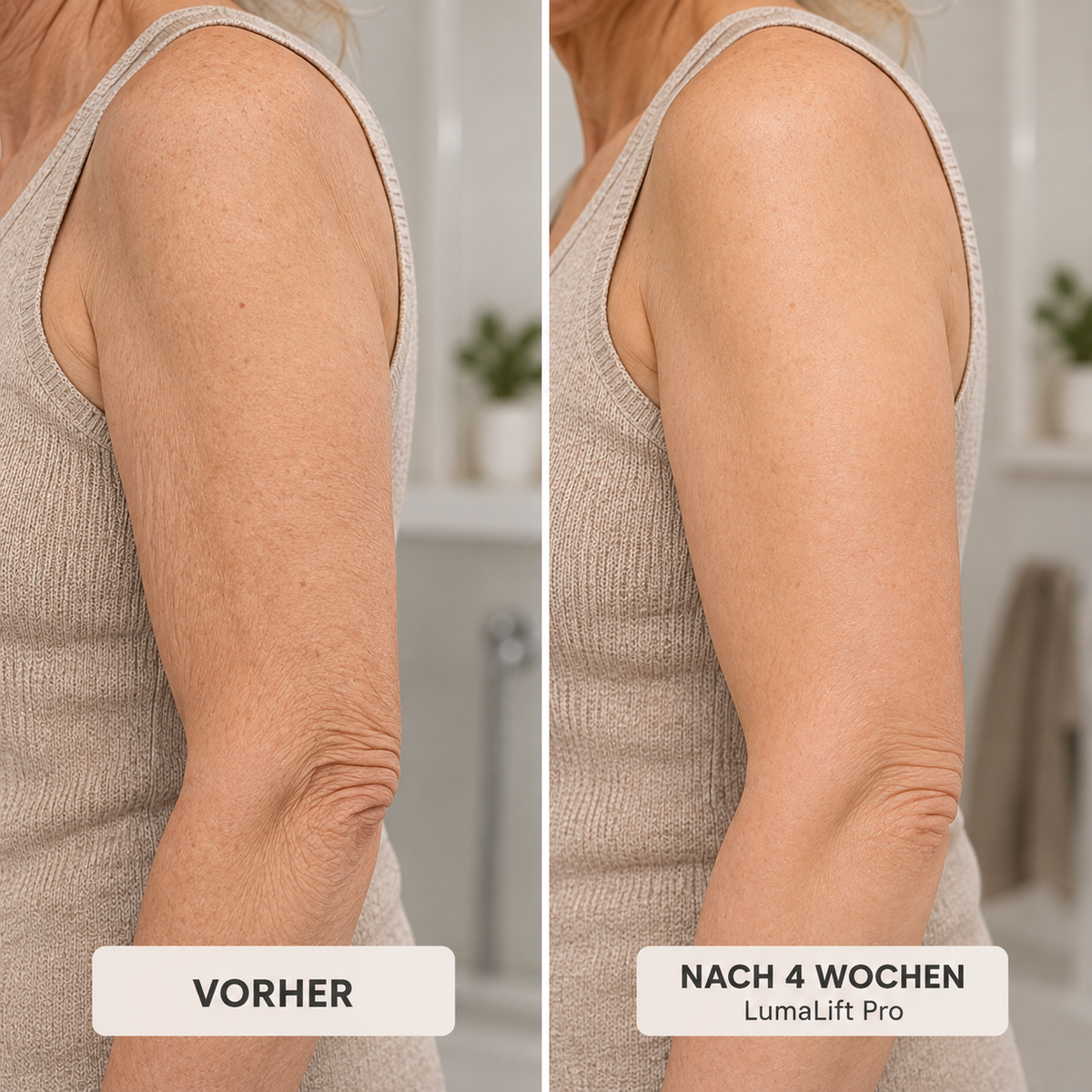 LumaLift Pro - Gerät zur Formung und Straffung von Armen & Körper
